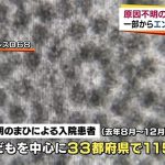 エンテロウイルス